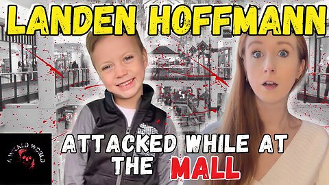 He Shattered the Bones in his Face- The Story of Landen Hoffmann