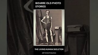 THE LIVING HUMAN SKELETON - Bizarre Ancient Photo Stories
