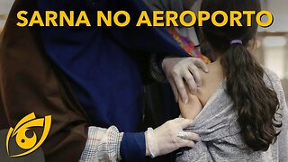 SURTO de SARNA atinge REFUGIADOS AFEGÃOS no AEROPORTO de Guarulhos