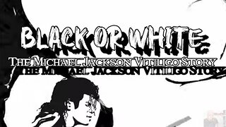 Black Or White: The Michael Jackson Vitiligo Story