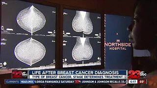 Life After Breast Cancer Diagnosis