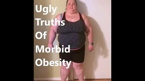 Ugly Truths of Morbid Obesity
