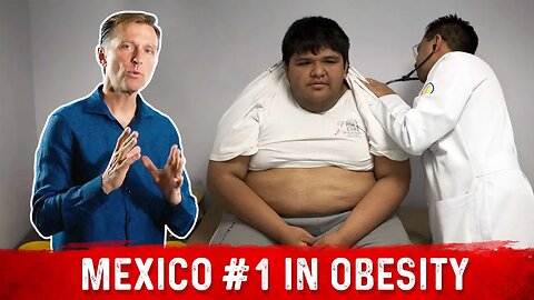 Why Did Mexico Surpass America in Obesity?