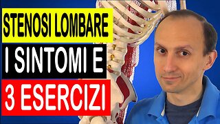 Stenosi Lombare: i Sintomi e i 3 Esercizi Migliori (Testati)