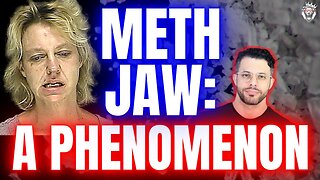 Meth Jaw