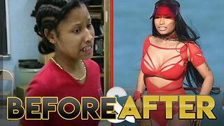 NICKI MINAJ | Before & After Transformation ( Plastic Surgery, Makeup & More )