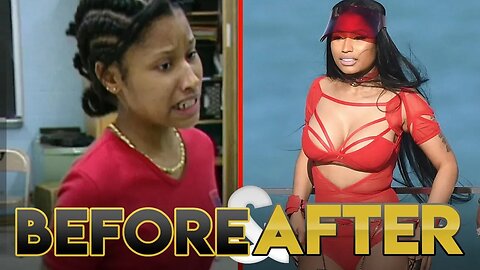 NICKI MINAJ | Before & After Transformation ( Plastic Surgery, Makeup & More )