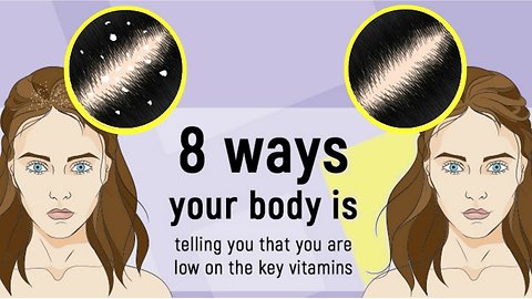 8 Signs That Your Body Is Low On Essential Vitamins