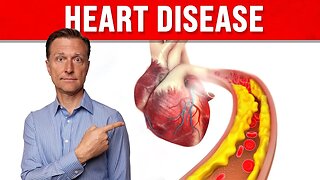 6 UNEXPECTED Signs of Heart Disease THAT YOU MUST KNOW!