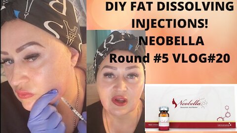 FAT DISSOLVING INJECTINS CHIN AREA WITH DR. LIPO/ NEOBELLA ,VLOG#2 #fatdissolving #neobella 4.10.21