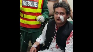 Assassination Attempt Imran Khan sustains bullet injury One person dies six injured