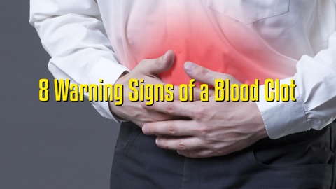 8 Warning Signs of a Blood Clot