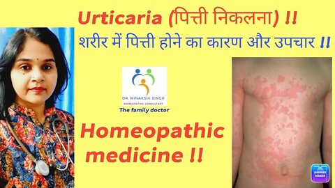 Urticaria || पित्ती होने के कारण और उपचार || #शीतपित्त #urticaria #homeopathic