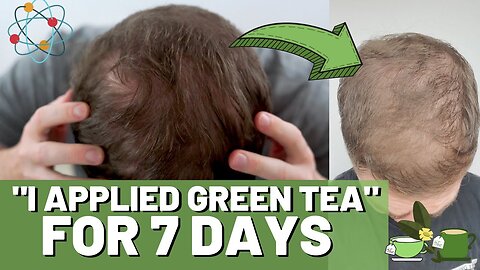 Green Tea For Hair Growth! 7 DAY RESULTS! Topical and Internal!