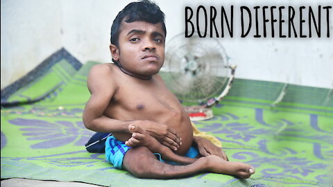 The Man With Bendy Bones | BORN DIFFERENT