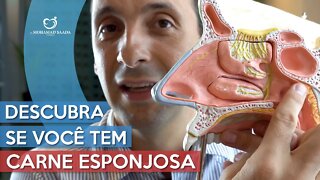 Saiba tudo sobre carne esponjosa, sintomas, tratamentos, dicas e mais