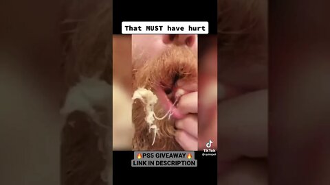 Huge cyst inside mouth gets popped 😱🫣 #shorts #pimplepopping #pimple #pimples #cystpopping #cyst