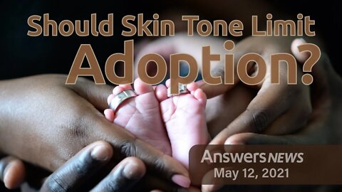 Should Skin Tone Limit Adoption? - Answers News: May 12, 2021