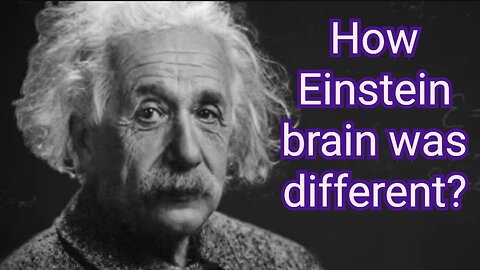 Einstein brain is different from us