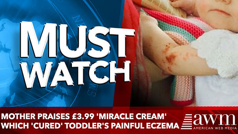 Mother praises £3.99 'miracle cream' which 'cured' toddler's painful eczema