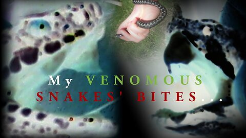 My VENOMOUS SNAKES’ BITES (EN audio)