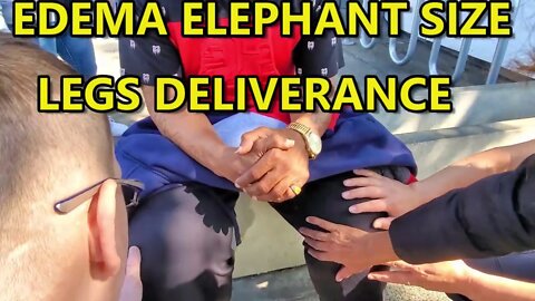 🔥ELEPHANT SIZE LEGS SWELLING EDEMA DELIVERANCE