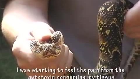 Guy gets bit by extremely venomous snake
