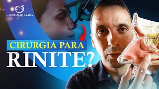 Existe Cirurgia para Rinite? Rinite Alérgica trata com Cirurgia? Descubra tudo