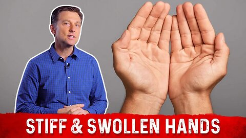 Remedies For Swollen Hands Explained By Dr.Berg