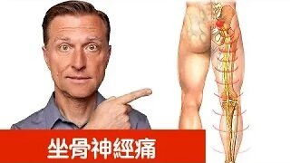 5分鐘內減輕坐骨神經痛,補銅與高銅食物,自然療法,柏格醫生 Dr Berg