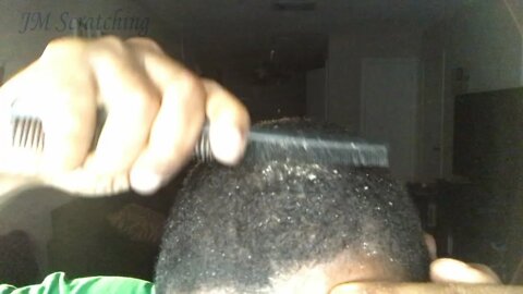 Quick Dandruff Scratching and Oil