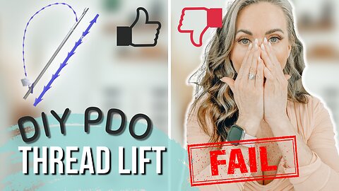 DIY PDO Thread Lift Gone Wrong and Lessons Learned