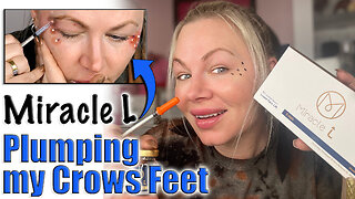 Plumping Crows Feet with Miracle L AceCosm | Code Jessica10 Saves you Money