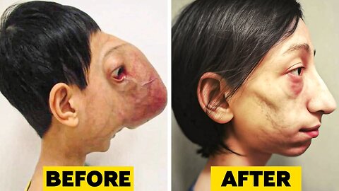 15 Kids Who Had Extreme Plastic Surgery