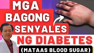 Mga Bagong Senyales ng Diabetes (Mataas Blood Sugar) - By Doc Willie Ong