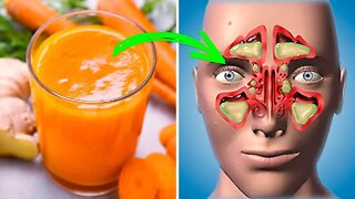 Do You Suffer From Allergic Rhinitis or Sinusitis? Then Try This Home Remedy!