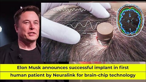 Musk says Neuralink has implanted brain chip