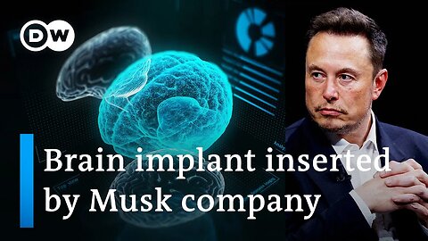 Elon Musk's Neuralink Implants First Chip in Human Brain | DW News