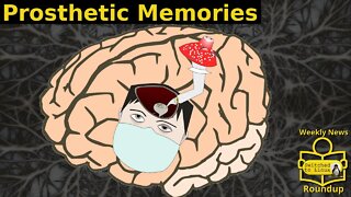 Prosthetic Memories