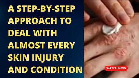 A Step-by-Step Approach to Deal With Almost Every Skin Injury and Condition