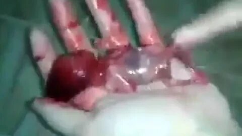 ¿Que un feto no es un ser humano? Yo creo firmemente que si!!!!