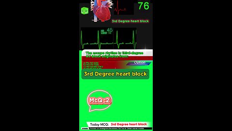 Third Degree Atrioventricular Block: heart, cardiology, atrioventricular block,MCQS