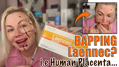 Can you BAP Laennec Aka Human Placenta? AceCosm | Reverse Aging | Code Jessica10 Saves you Money!