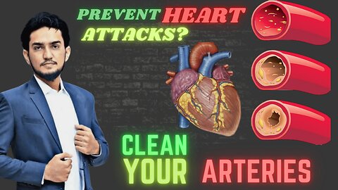 These Foods Unclog Arteries & also Prevent Heart Attack