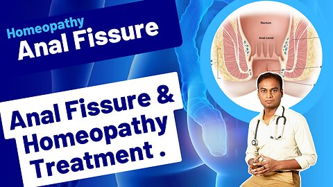 Anal Fissure and Homeopathy Treatment. Dr. Bharadwaz | Homeopathy, Medicine & Surgery