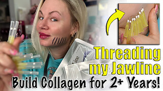 Threading my Jawline, build collagen for 2 years! AceCosm, Code Jessica10 Saves you money