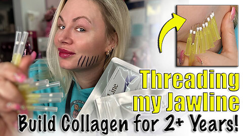 Threading my Jawline, build collagen for 2 years! AceCosm, Code Jessica10 Saves you money