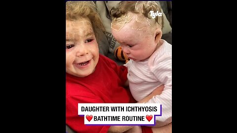 Daughter with lcthyosis night time routine