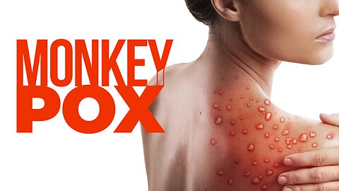 PEOPLE REFUSE TO SUCCUMB TO MONKEYPOX PANDEMIC PROPAGANDA