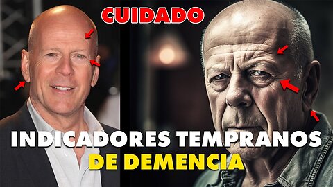 PUEDES TENER DEMENCIA Y NO SABERLO - Primeros signos de Alzheimer y Demencia - Cómo Prevenirlos